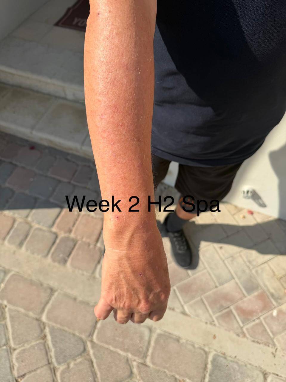 Week 2 of H2 Shower progress